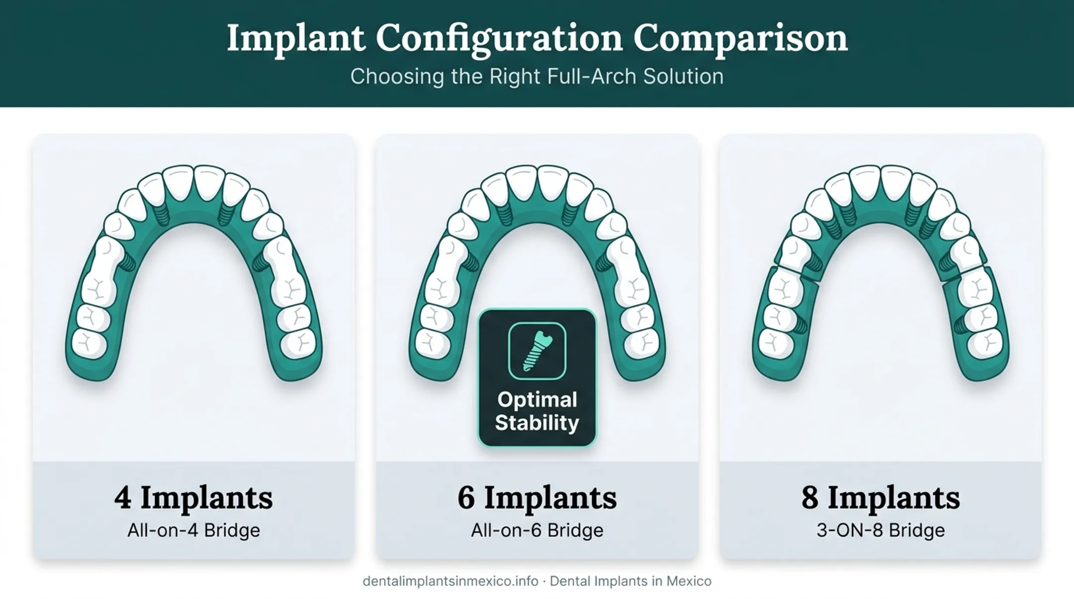 All-on-4 All-on-6 and 3-ON-8 implant count comparison diagram