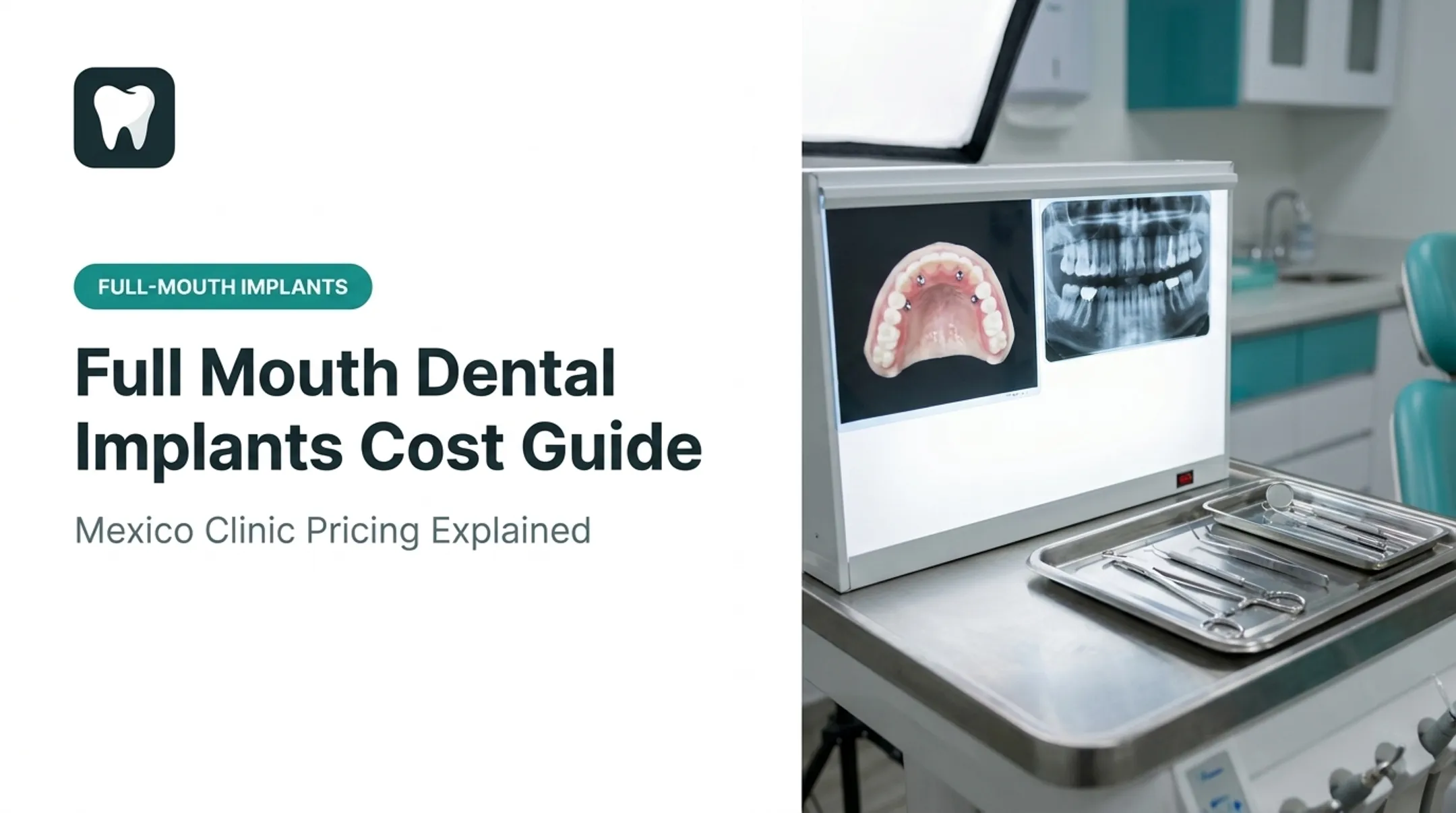 Full Mouth Dental Implants Cost Guide
