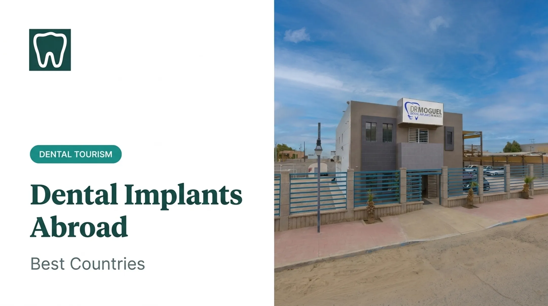 Dental Implants Abroad: Best Countries