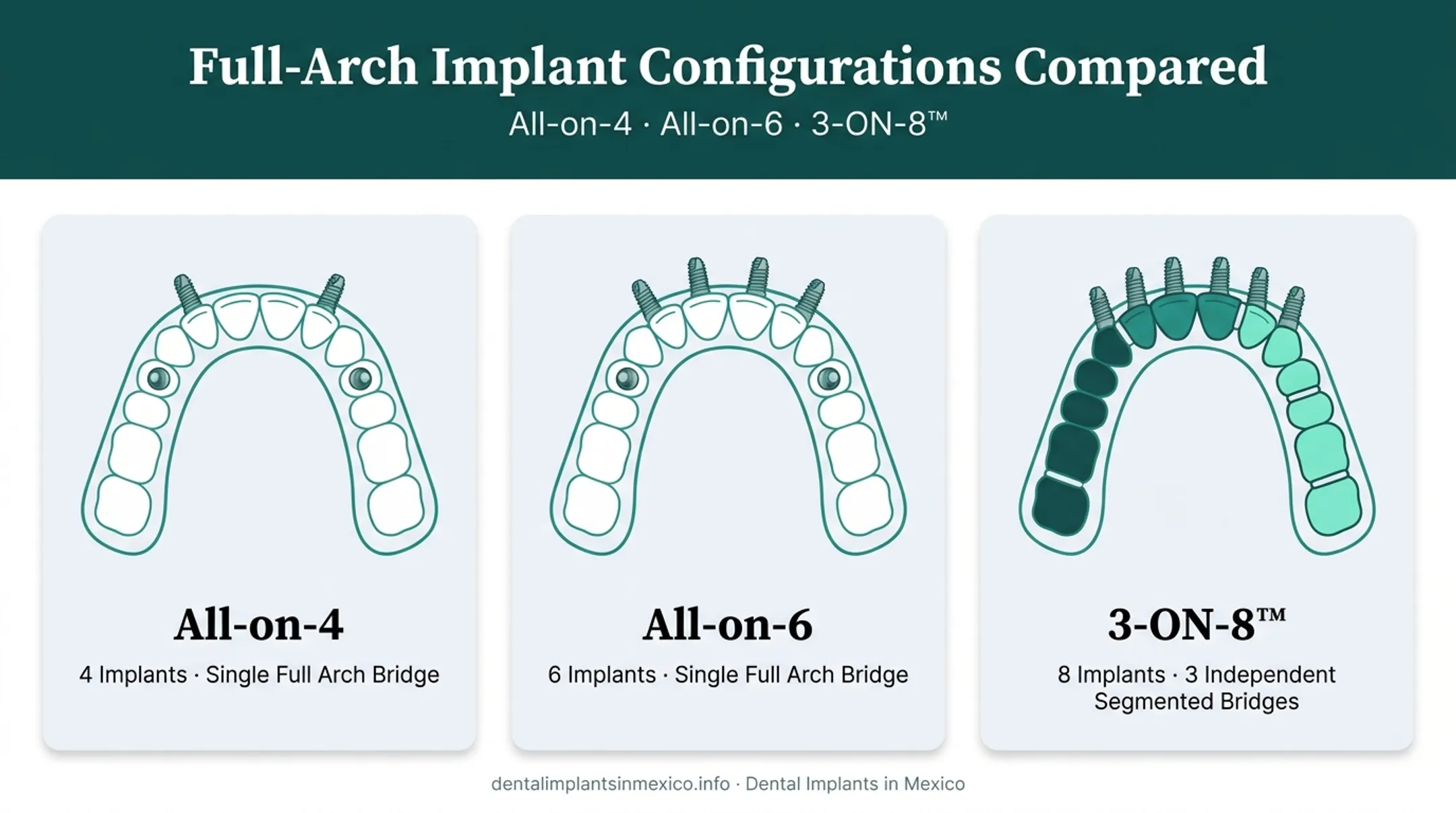 Comparison of All-on-4 All-on-6 and 3-ON-8 implant configurations