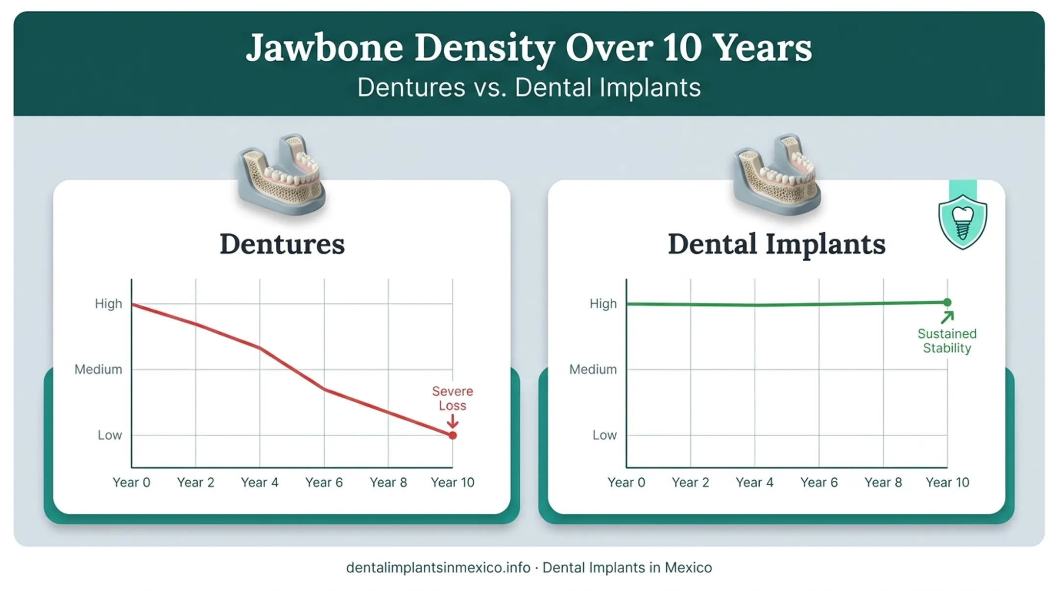 Dental implants versus dentures bone loss comparison over time