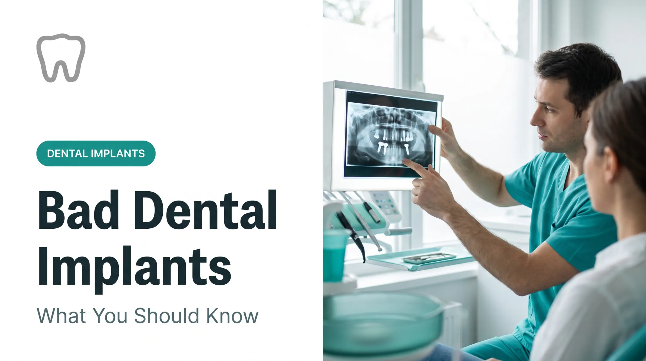 Bad Dental Implants: What You Should Know