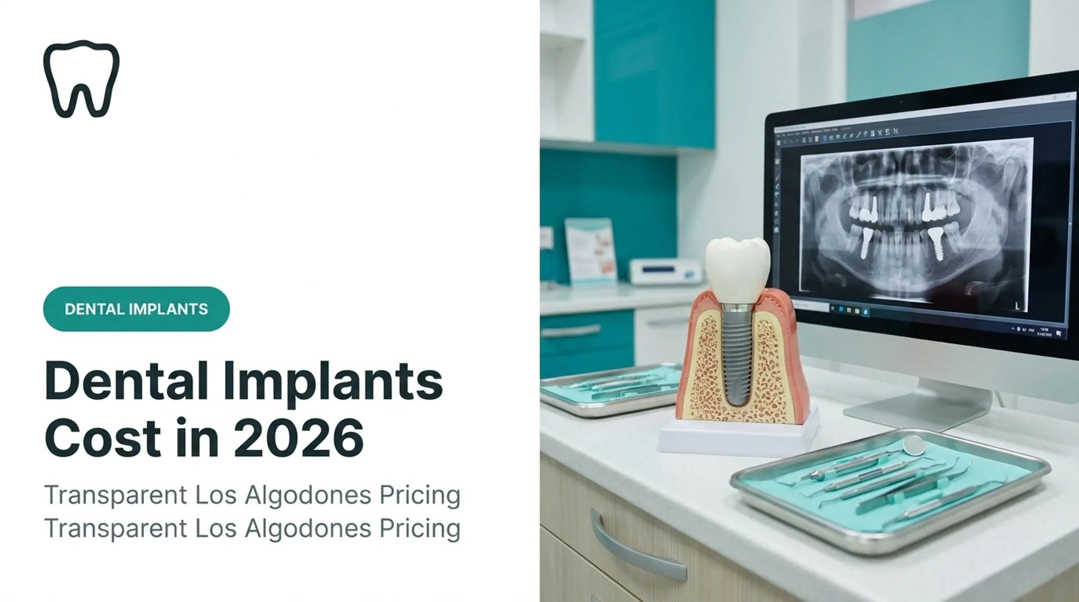 Dental Implants Cost in 2026