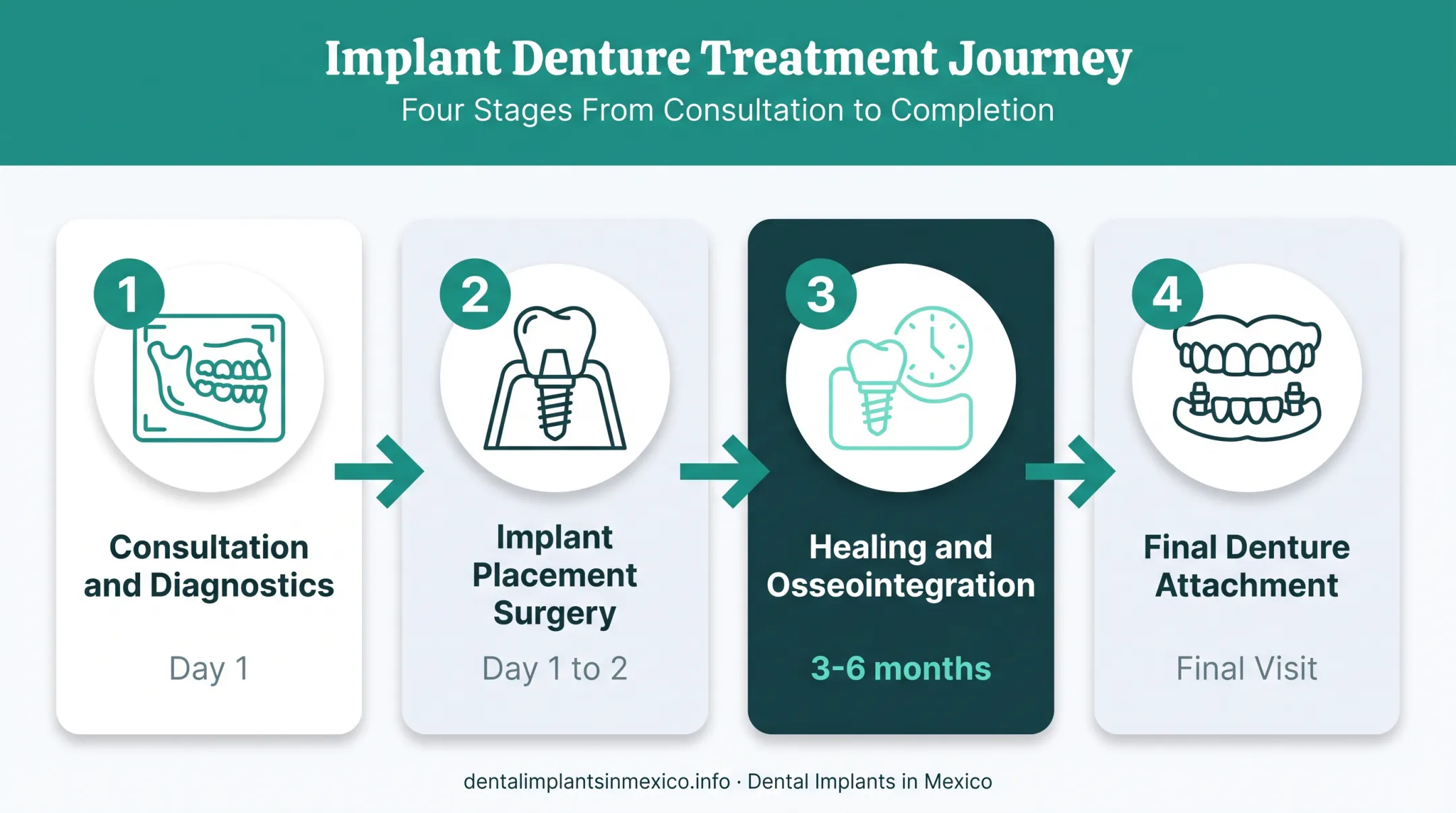 Four-step implant denture treatment process from consultation to final fitting