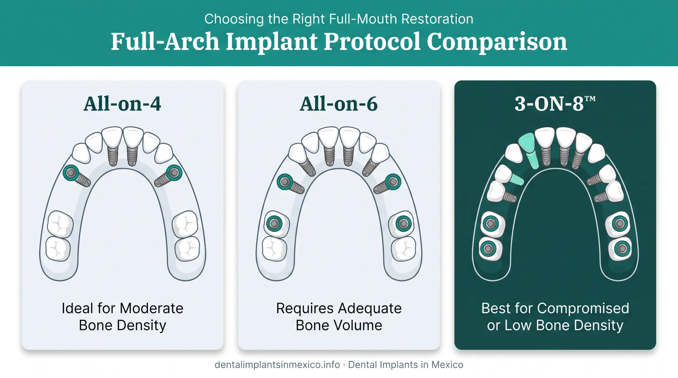 All-on-4 All-on-6 and 3-ON-8 implant protocols comparison diagram