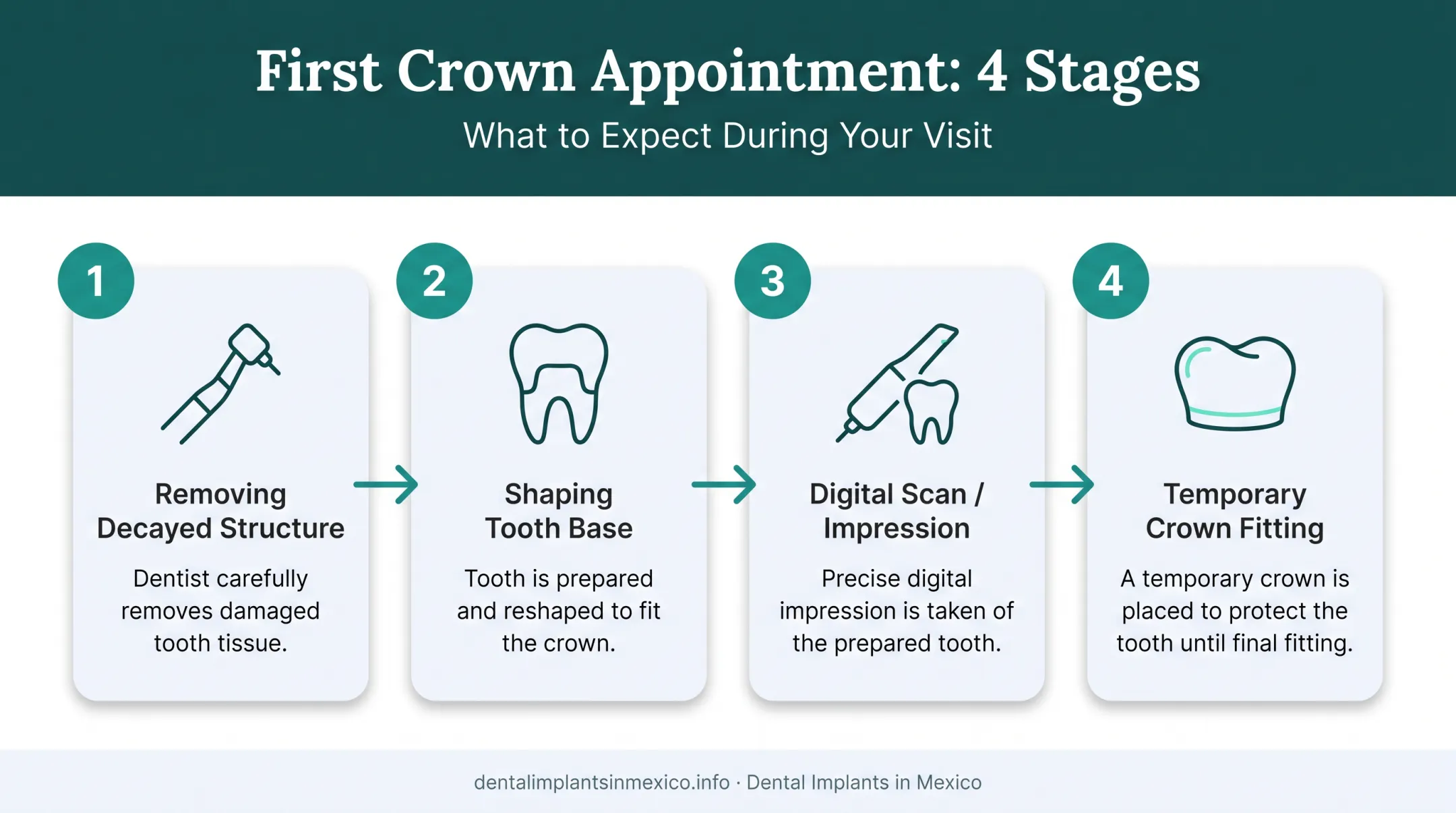 4-step dental crown preparation process from decay removal to temporary fitting