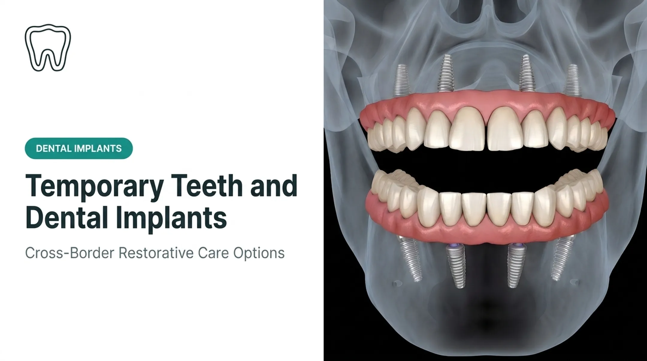 Temporary Teeth and Dental Implants
