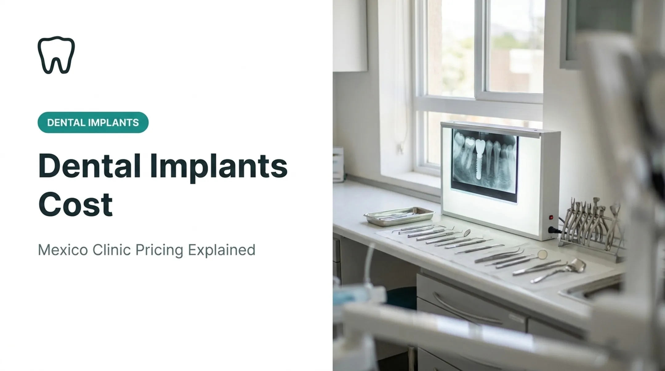 Dental Implants Cost