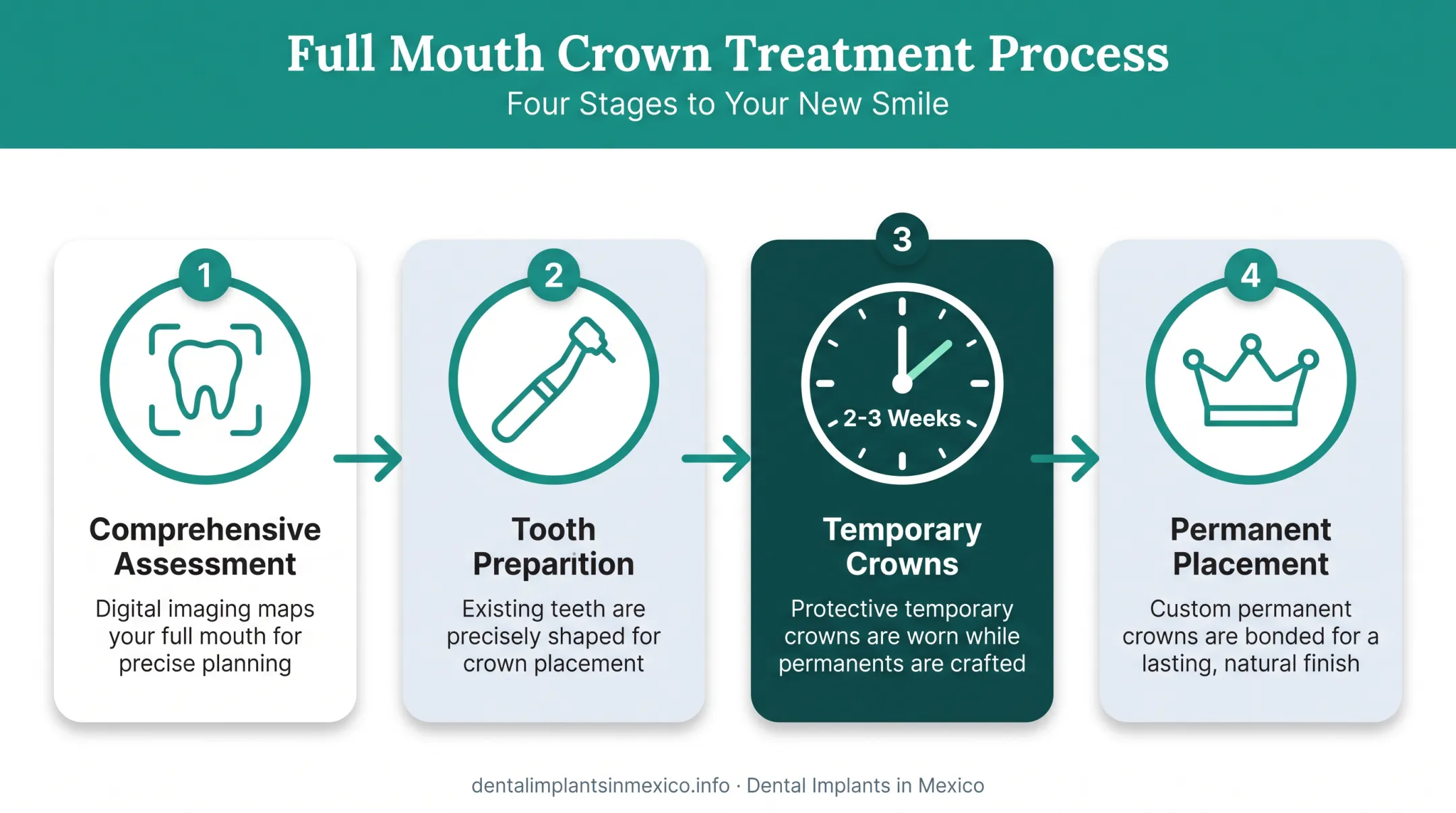 4-step full mouth dental crown treatment process from assessment to placement