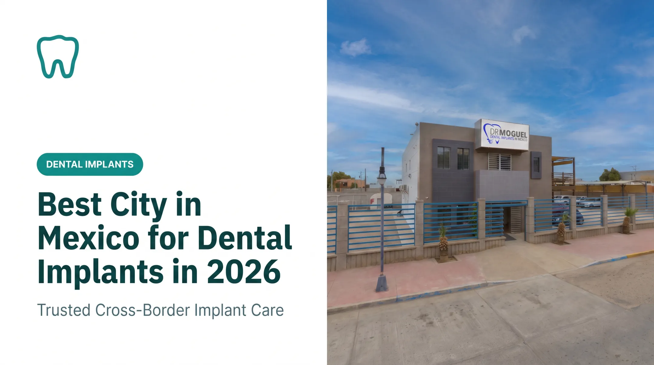 Best City in Mexico for Dental Implants in 2026