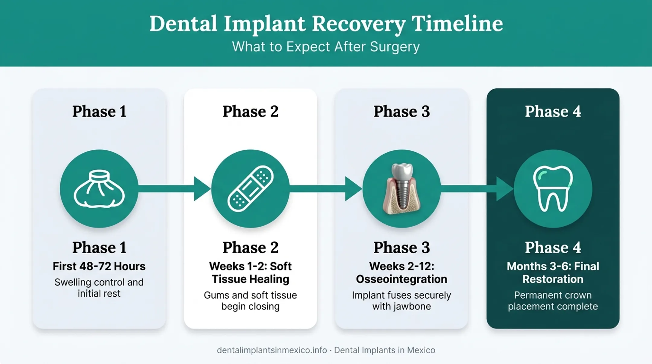Four-phase full arch dental implant recovery timeline from surgery to final restoration
