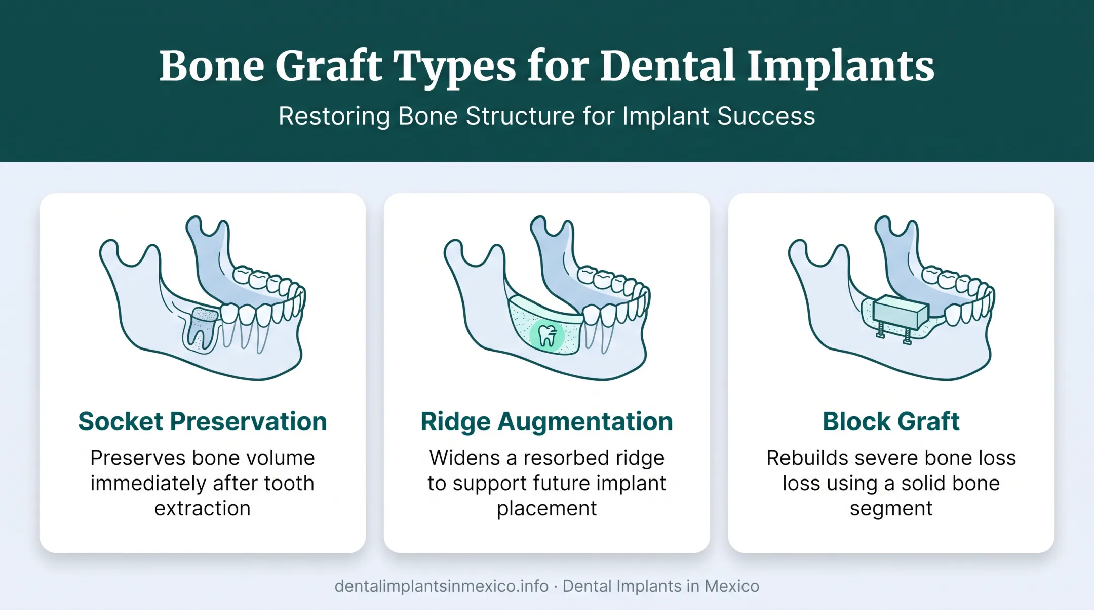 Three types of dental bone grafts socket preservation ridge augmentation block graft