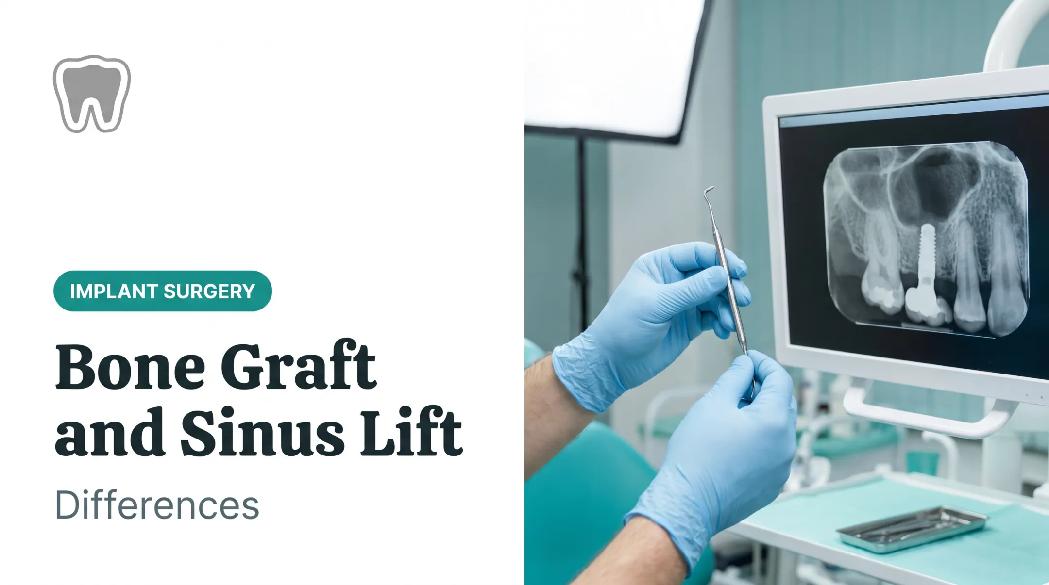 Bone Graft and Sinus Lift: Differences