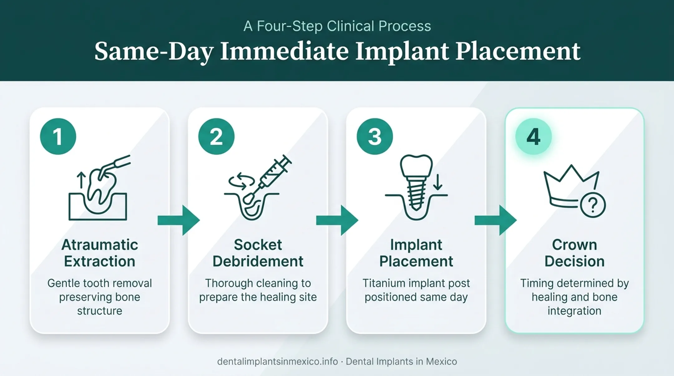 Four-step same-day immediate implant placement surgical sequence