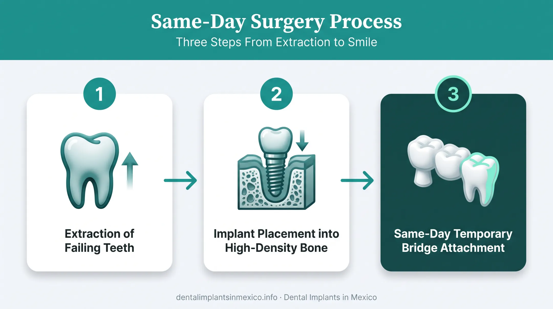 Immediate load dental implant surgical day three-step procedure