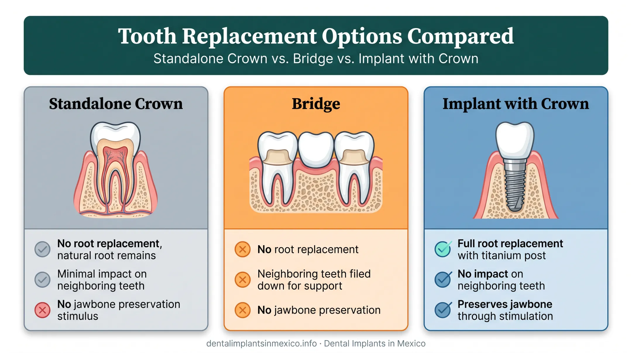 Dental implant with crown versus bridge versus standalone crown comparison