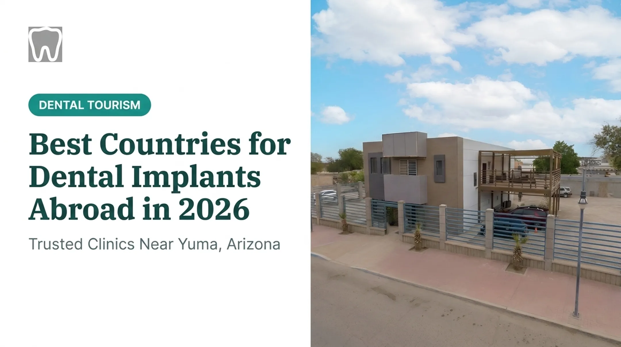 Best Countries for Dental Implants Abroad in 2026