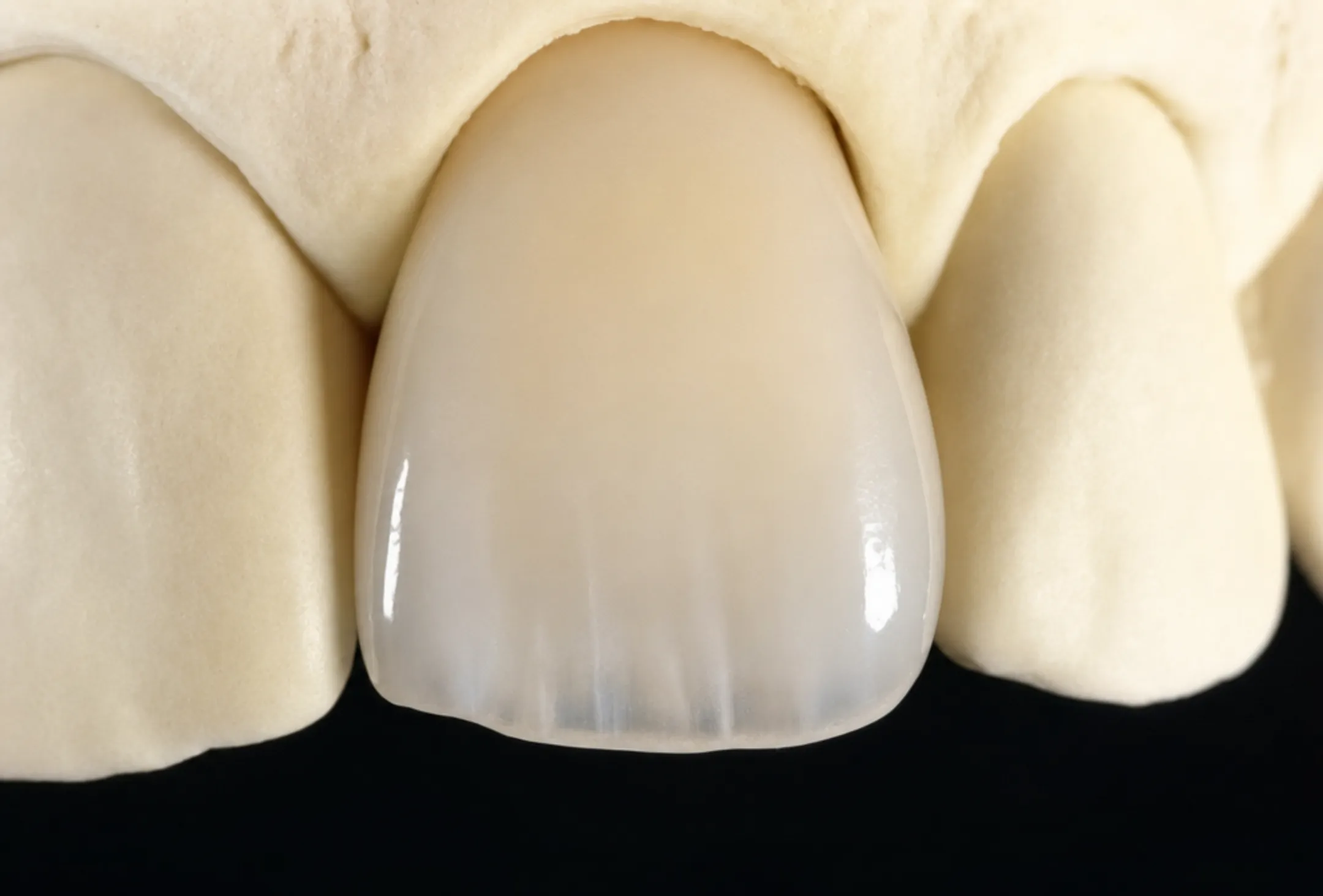 Zirconia dental crown milled with CAD CAM digital dental technology