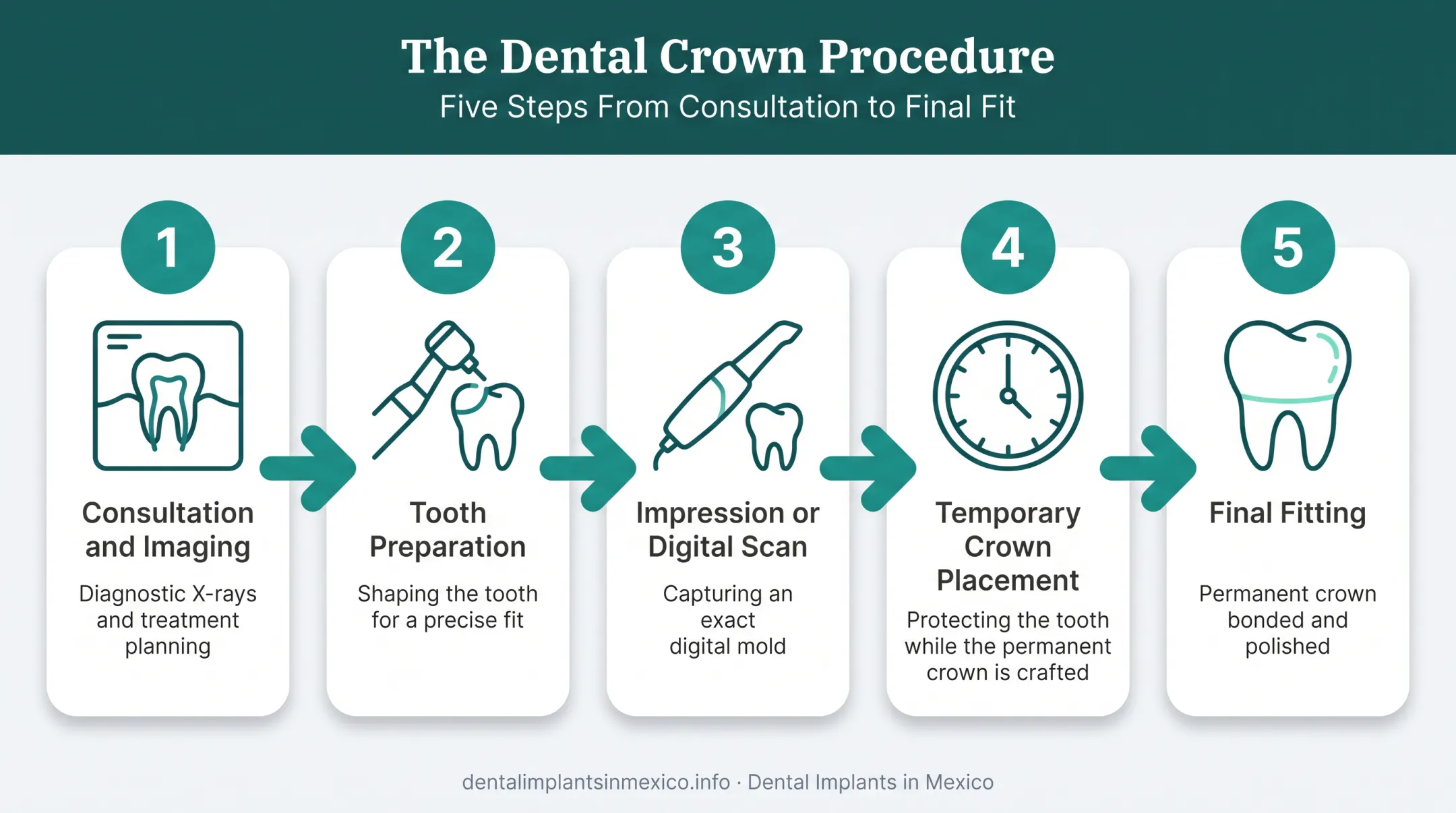 5-step dental crown procedure from consultation to final fitting