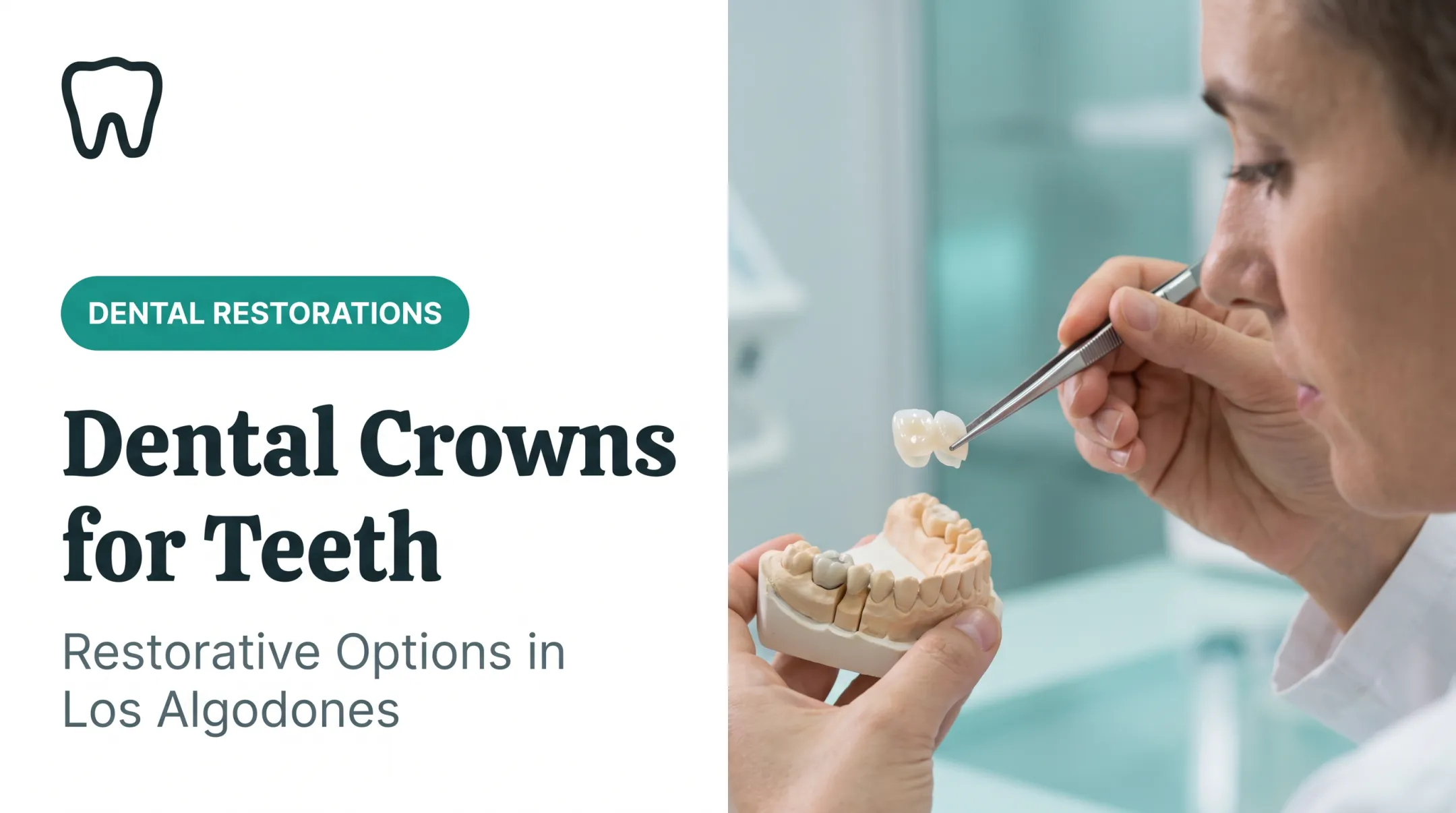 Dental Crowns for Teeth