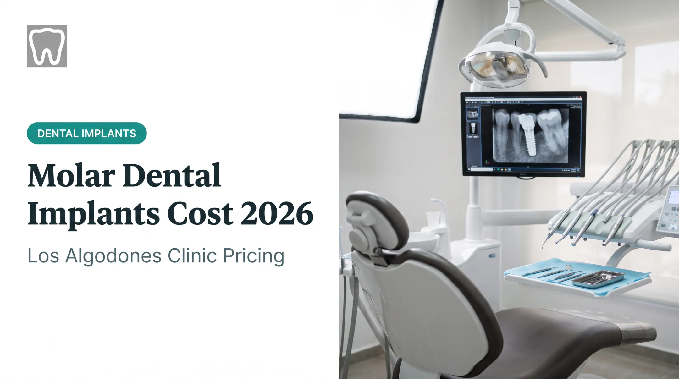 Molar Dental Implants Cost 2026