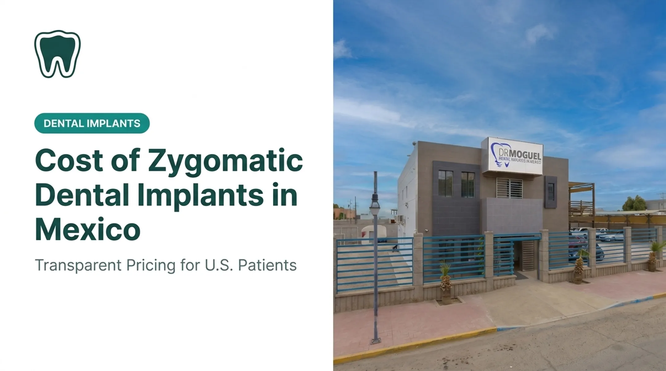 Cost of Zygomatic Dental Implants in Mexico