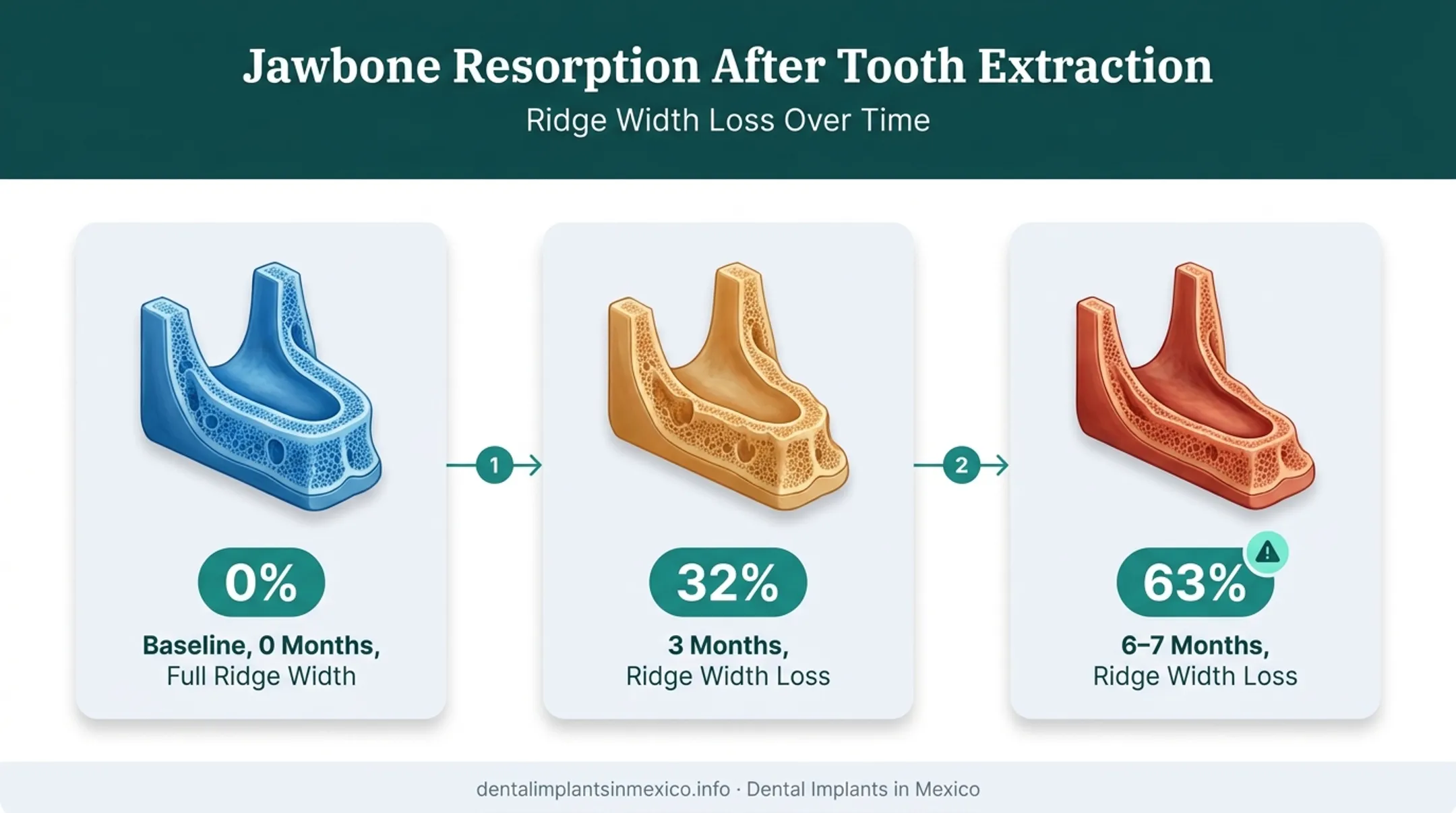 Jawbone ridge width loss timeline after tooth extraction infographic