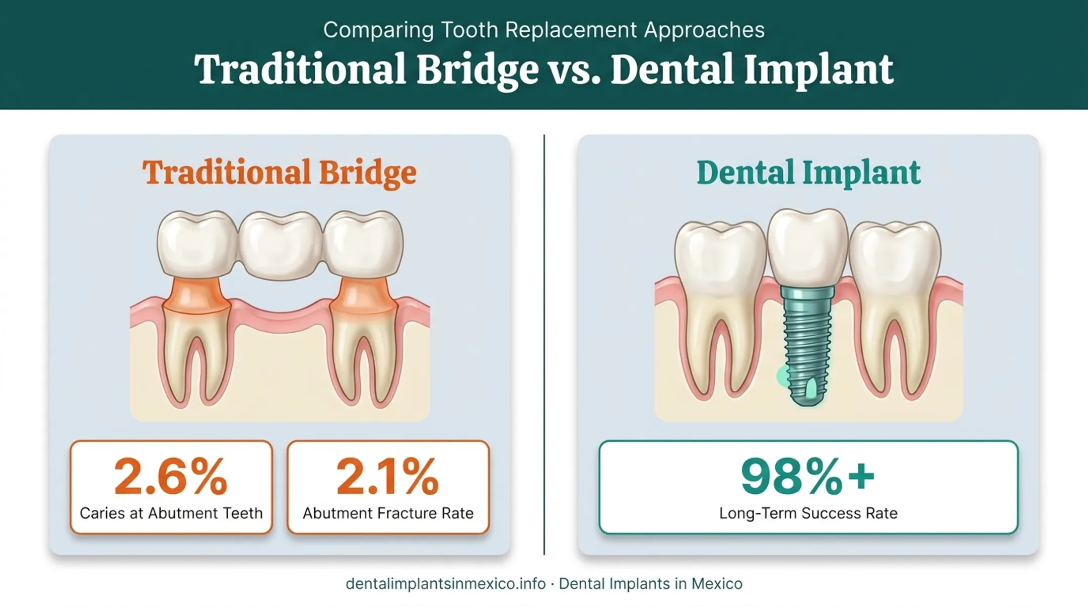 Dental implant versus traditional bridge tooth preparation comparison diagram
