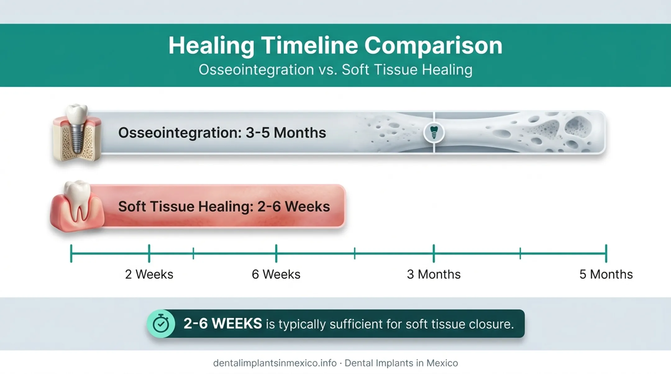 Osseointegration timeline versus gum tissue healing timeline comparison chart