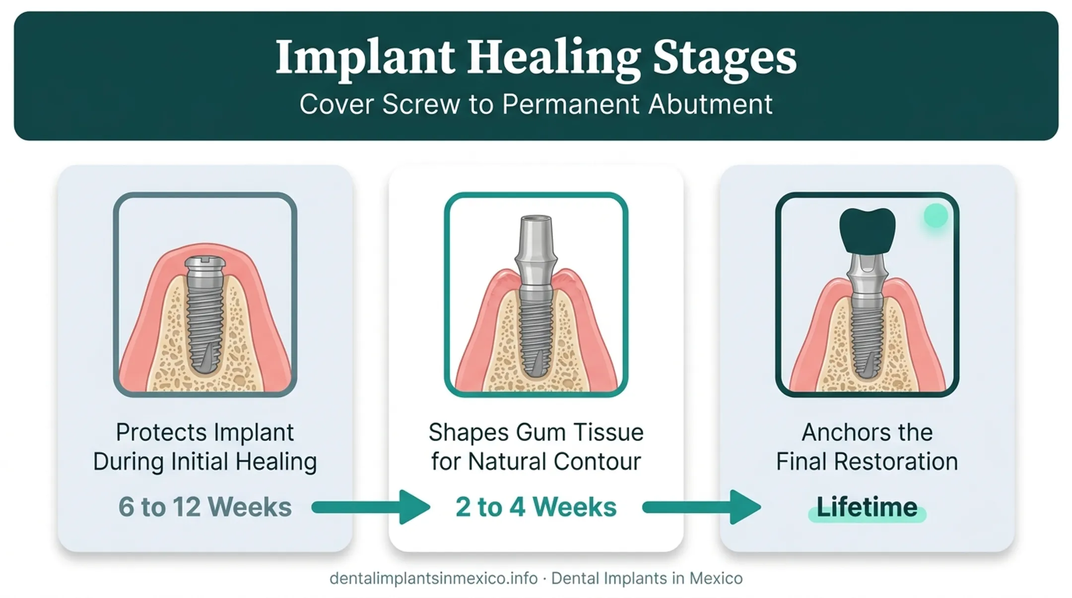 Cover screw healing abutment and permanent abutment side-by-side comparison