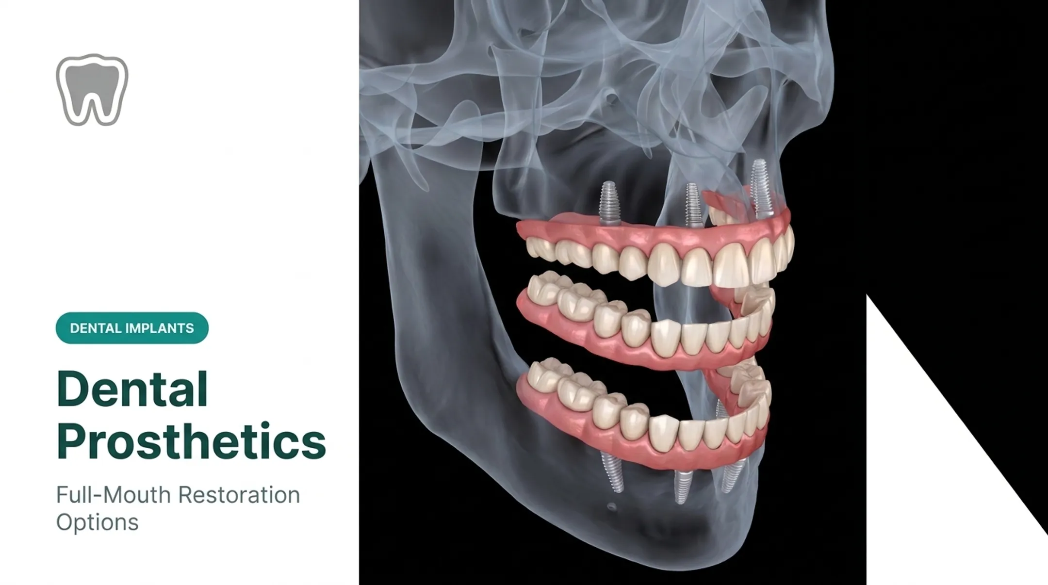 Dental Prosthetics