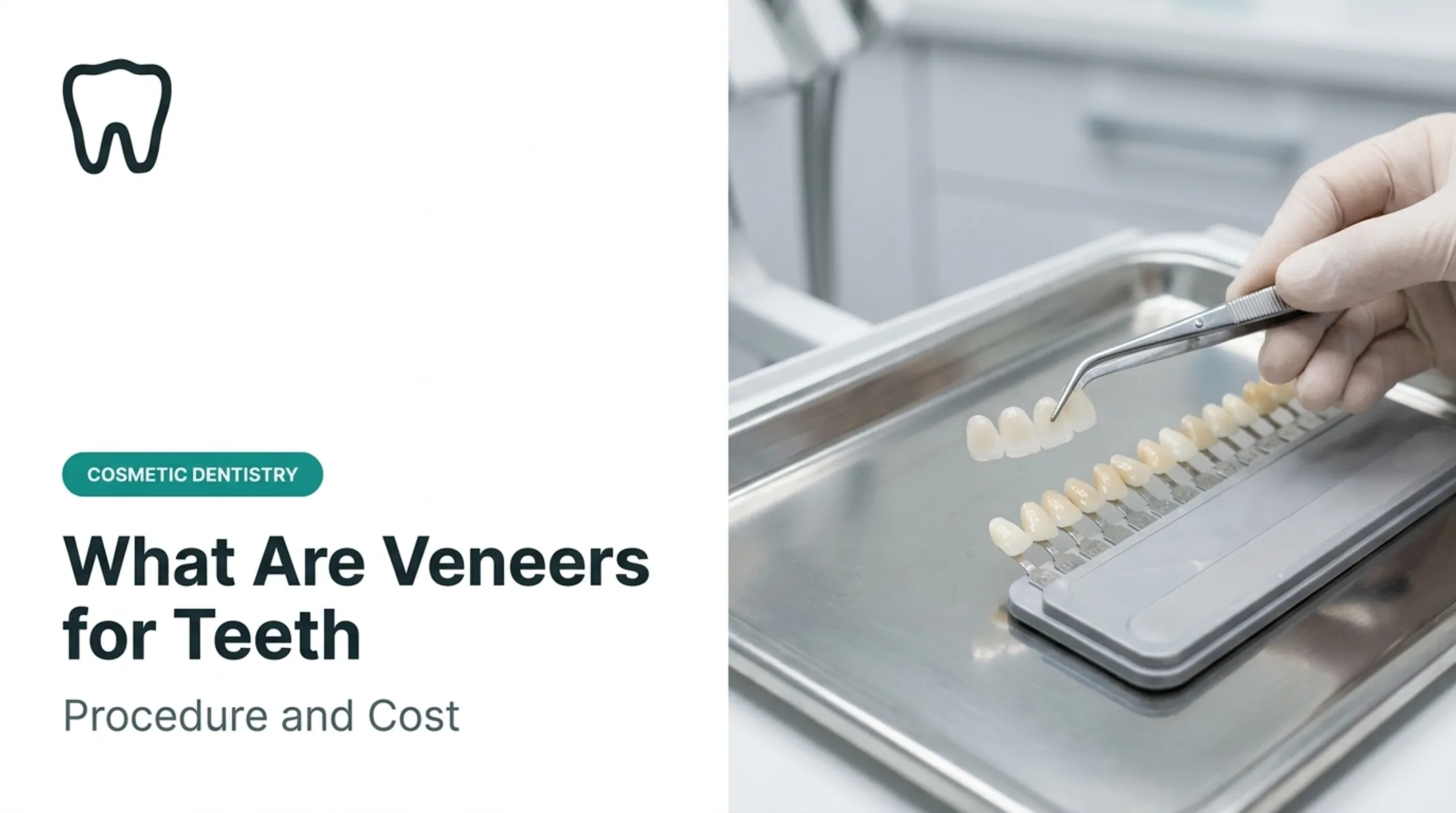 What Are Veneers for Teeth? Procedure and Cost
