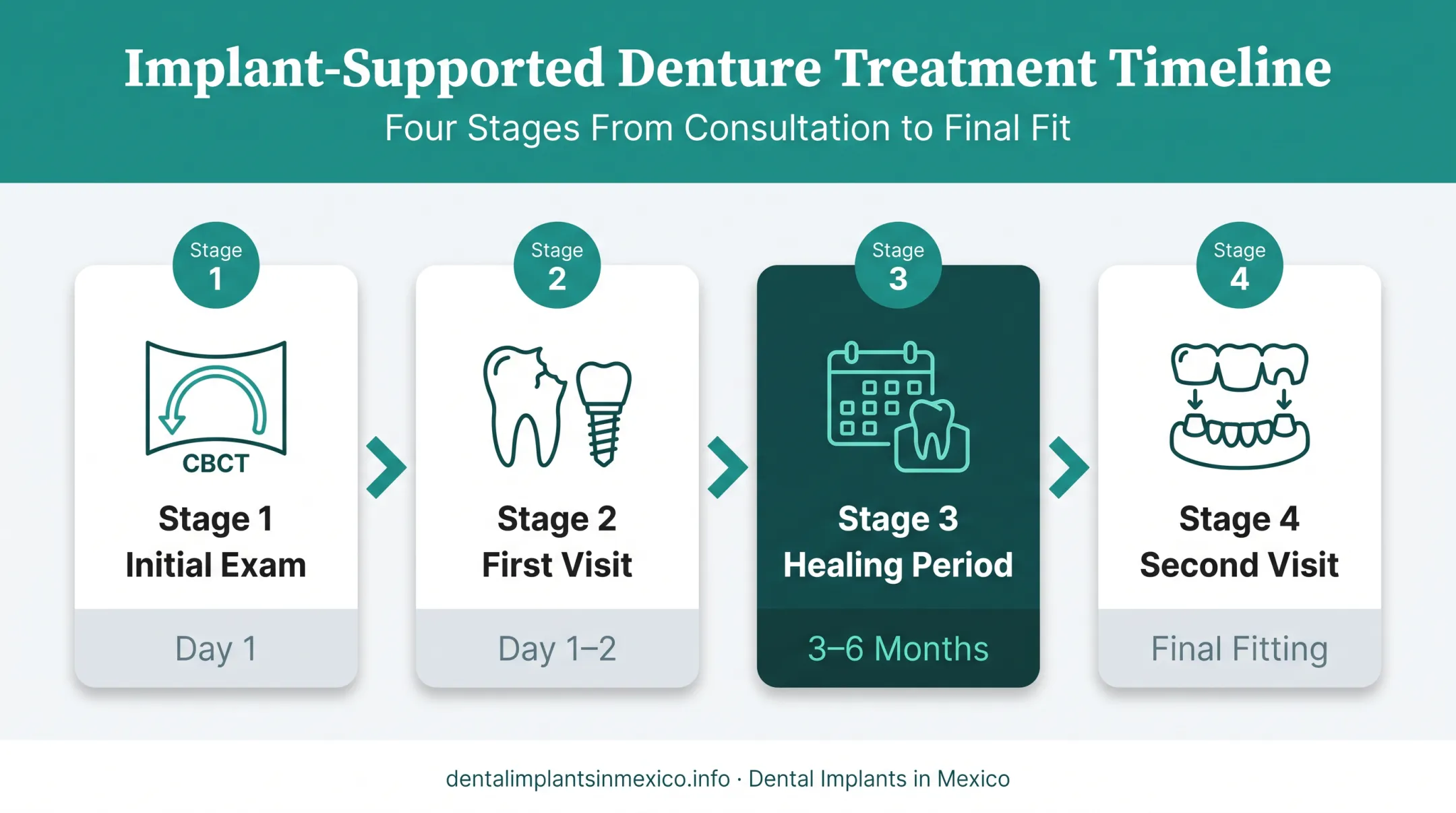 4-step implant-supported denture treatment timeline process