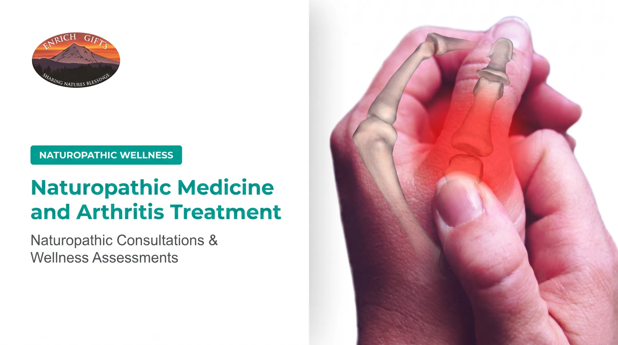 Naturopathic Medicine and Arthritis Treatment