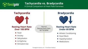 Tachycardia versus bradycardia heart rate comparison infographic