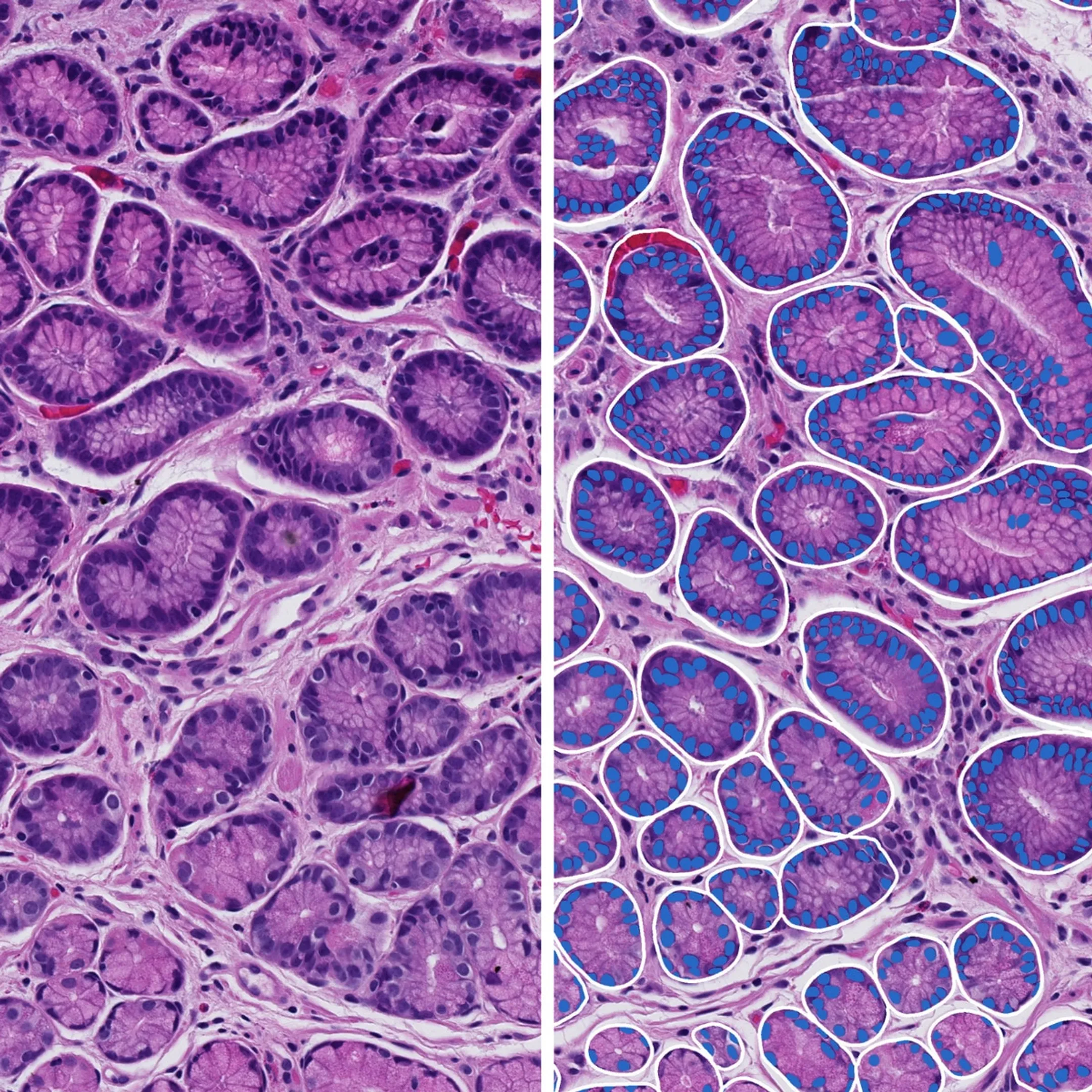 Targeted cells selected from a tissue section