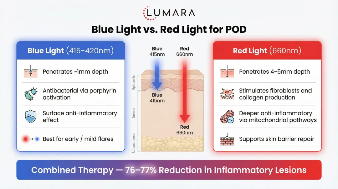 Blue versus red light therapy depth penetration and POD treatment comparison infographic