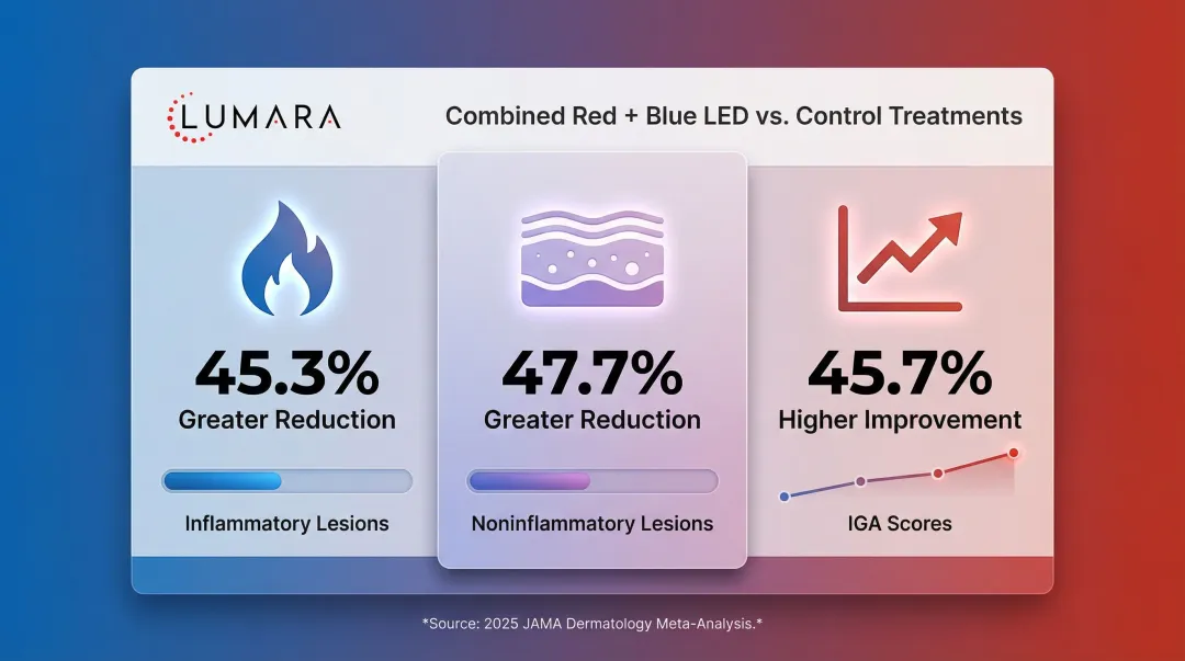 Red and blue LED combined therapy acne reduction statistics comparison infographic