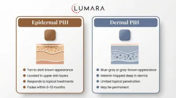 PIH topical treatment options: niacinamide, vitamin C, azelaic acid, tranexamic acid, and chemical exfoliants
