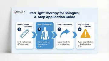 Red light therapy shingles protocol: dermatome targeting, session frequency, timing relative to antiviral treatment