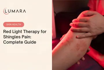 Red light therapy shingles mechanism: skin inflammation reduction and nerve-adjacent tissue support during acute phase