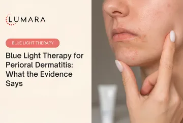 Blue Light Therapy for Perioral Dermatitis: What the Evidence Says