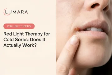 Cold sore management options comparison: OTC creams, topical antivirals, oral antivirals, and red light therapy
