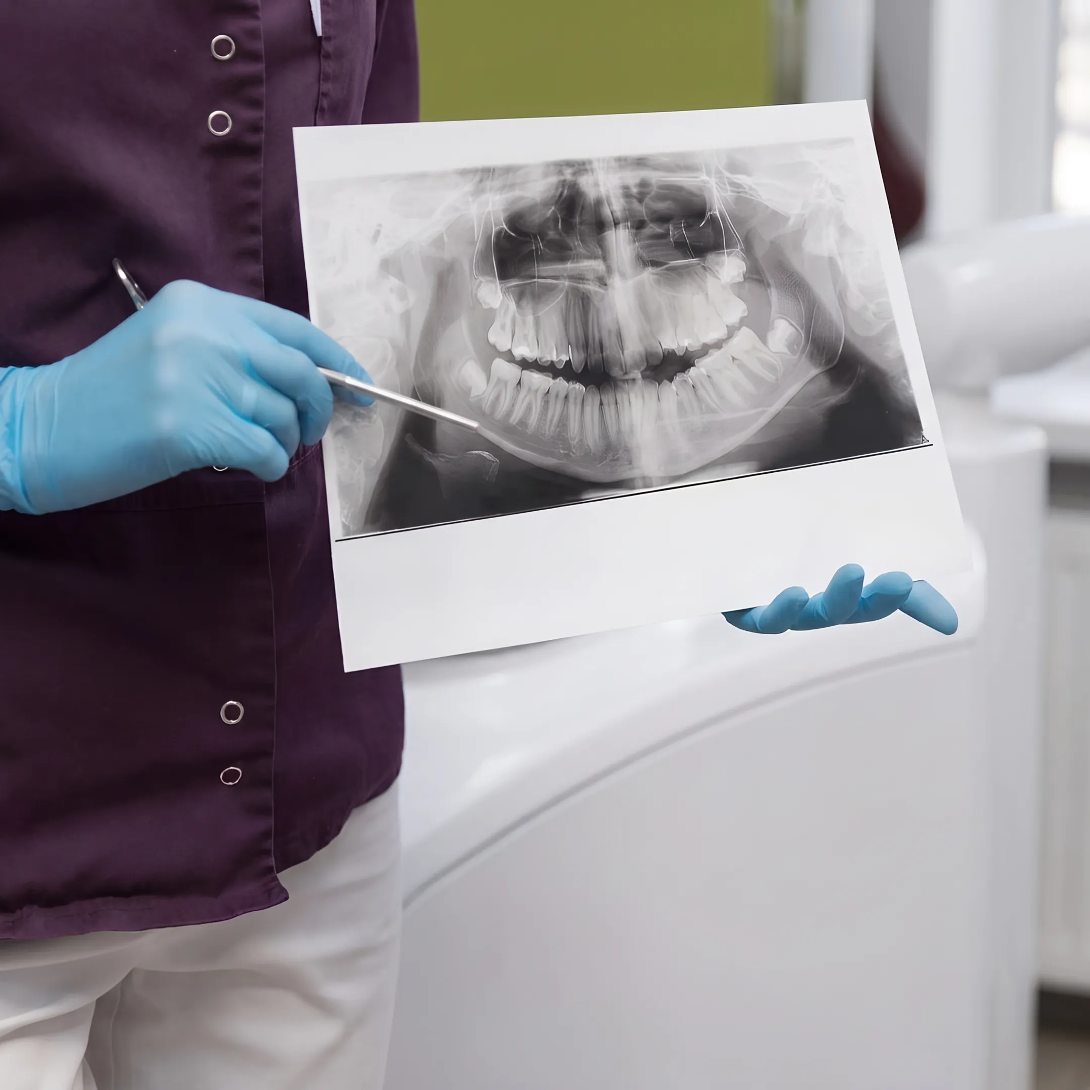Affordable Low-Cost Dental Implants in Georgia