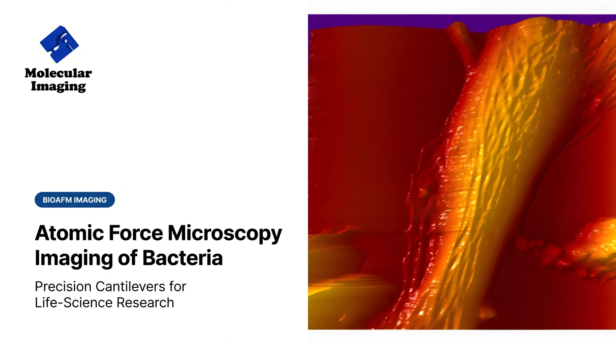 Atomic Force Microscopy Imaging of Bacteria