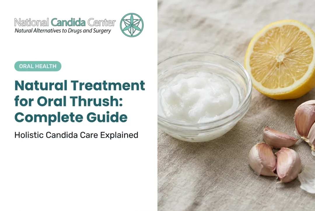 Natural Treatment for Oral Thrush: Complete Guide