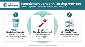 Three diagnostic testing methods for leaky gut comparison chart