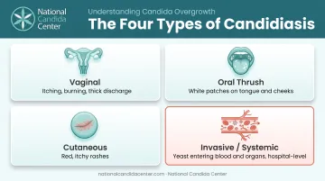 Four types of candidiasis infections vaginal oral skin and systemic