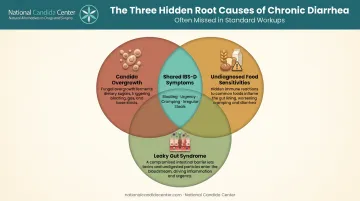 Three overlapping root causes of IBS-D Venn diagram infographic