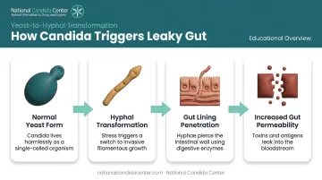 Candida yeast-to-hyphal transformation process causing intestinal leaky gut